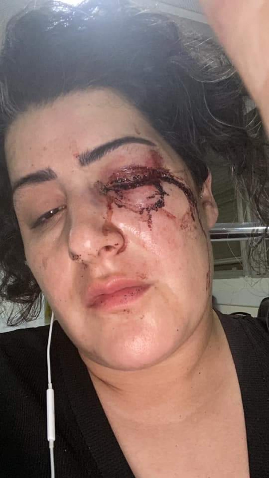 الإعلامية المقدسية رولين تفكجي تتعرض لاعتداء وحشي في بيتها