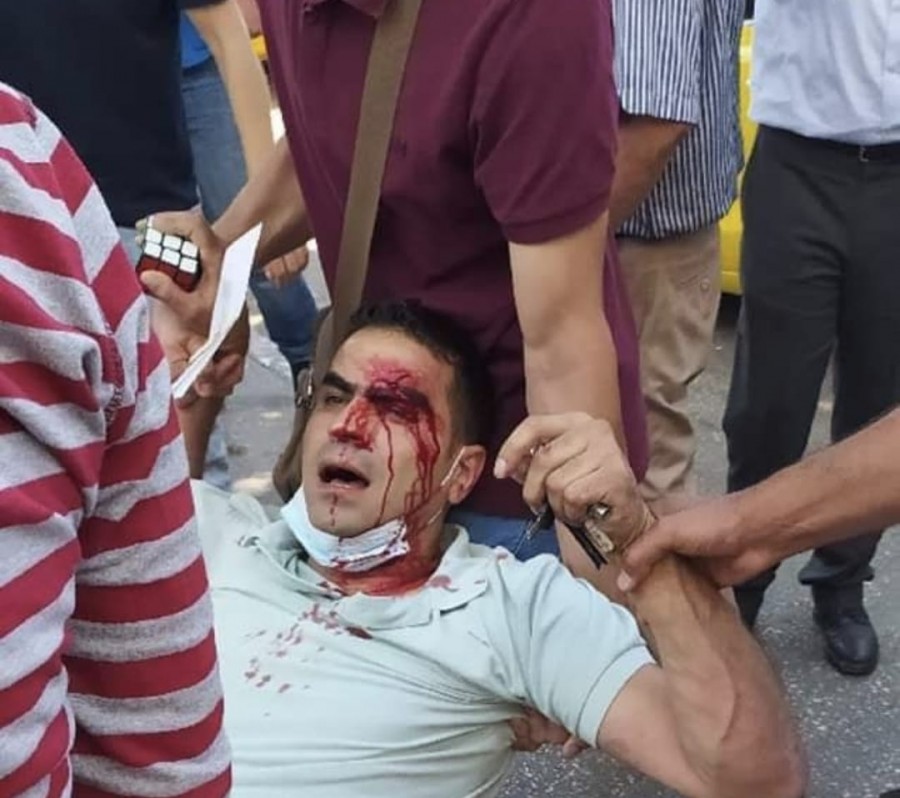 بالغاز والهراوات: السلطة الفلسطينيّة تقمع المحتجين على مقتل الناشط نزار بنات